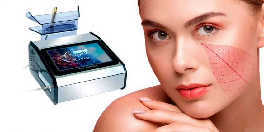 Як позбутися куперозу?