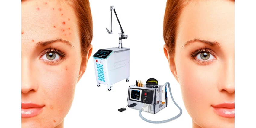 Як швидко позбутися прищів?