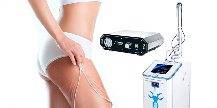 Як позбавитися від розтяжок?