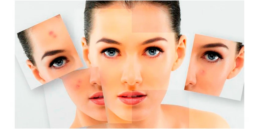 Професійне чищення шкіри обличчя та тіла