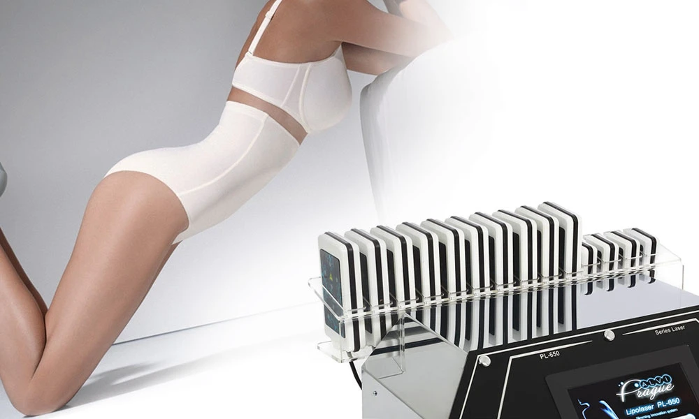 лазерний ліполіз