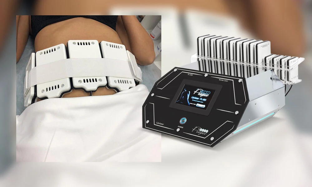 сутність методу лазерного ліполізу