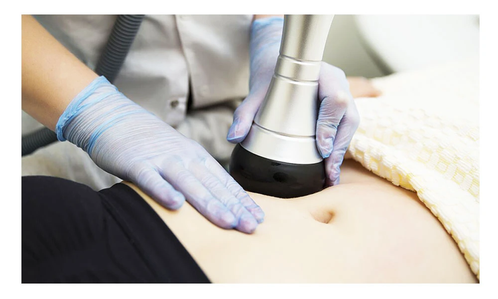 показання до кавітаційного ліполізу