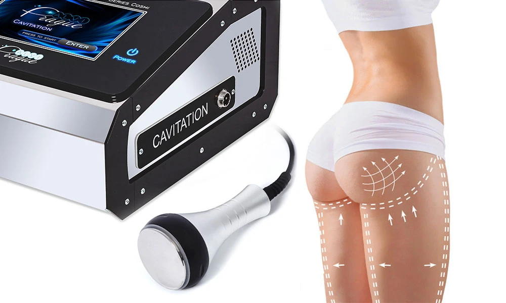 опис процедури ультразвукового ліполізу