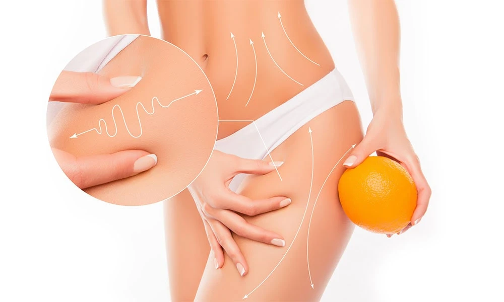 рекомендації після процедури кавітаційного ліполізу