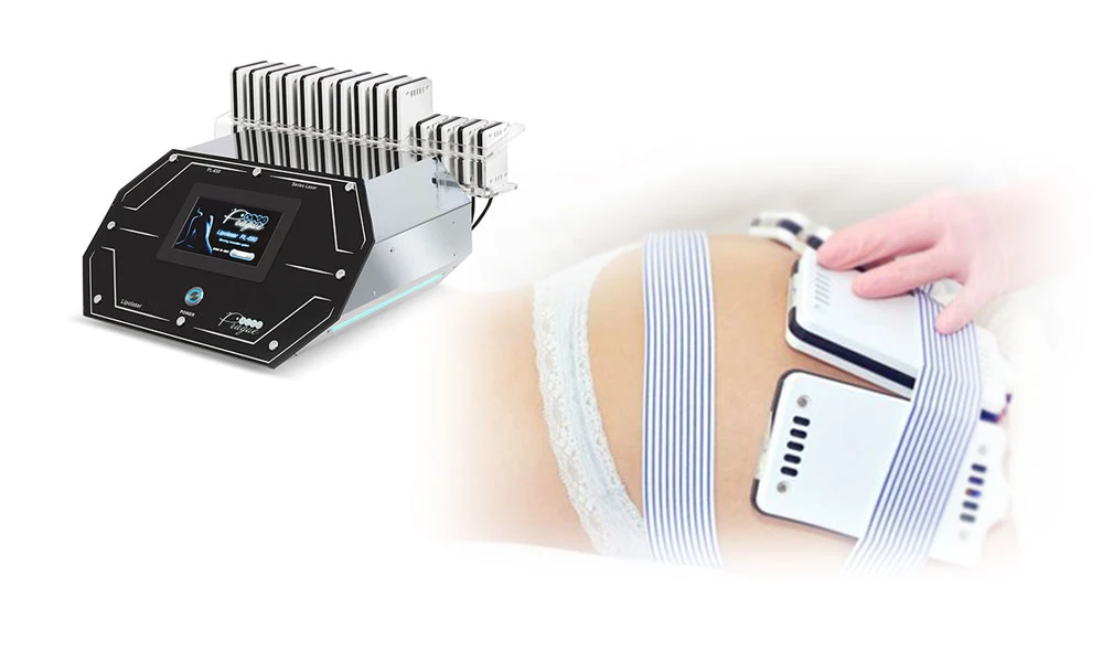 лазерний ліполіз при целюліті