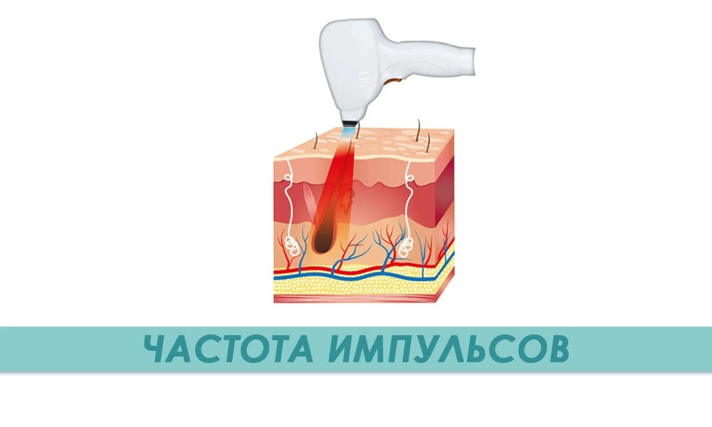 частота импульсов диодного лазера