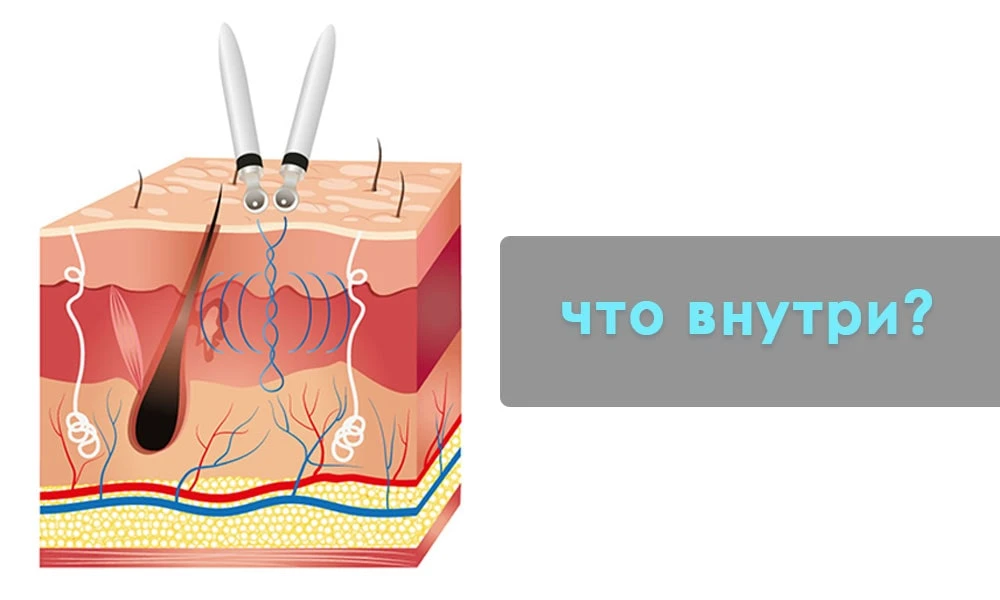 принцип роботи мікрострумів