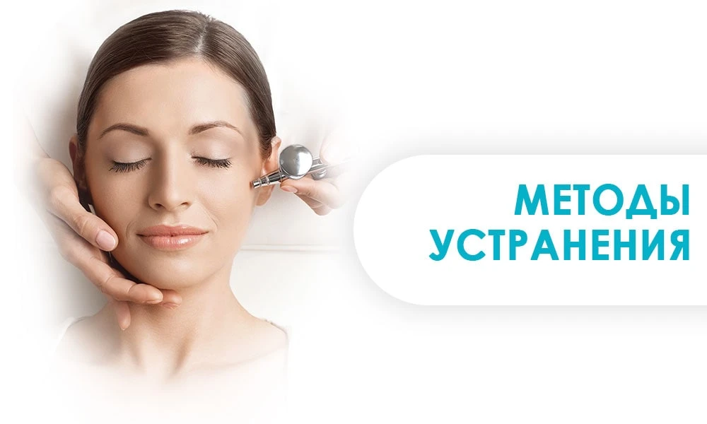 методы устранения тканевой гипоксии