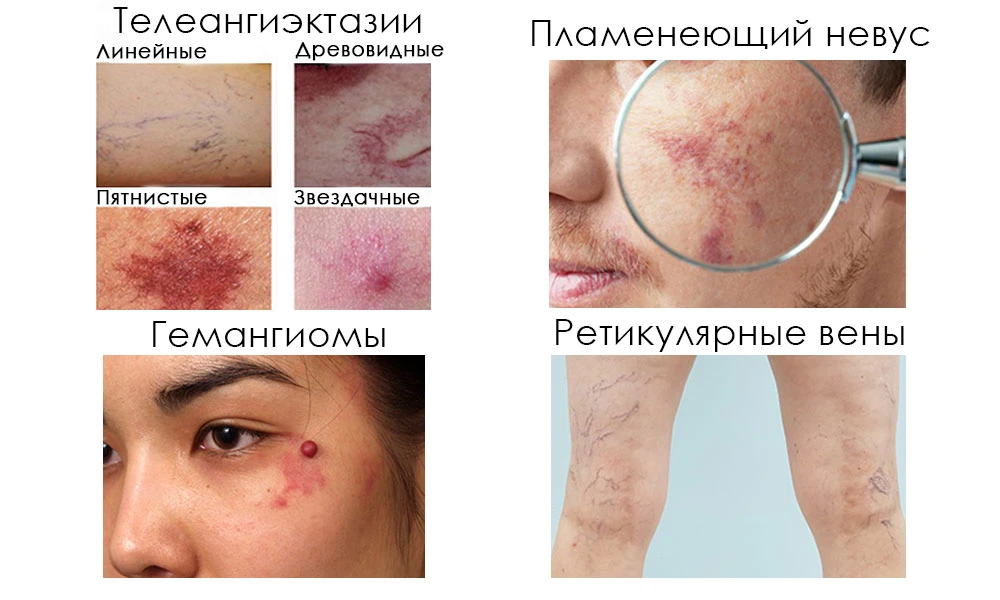 види судинних дефектів