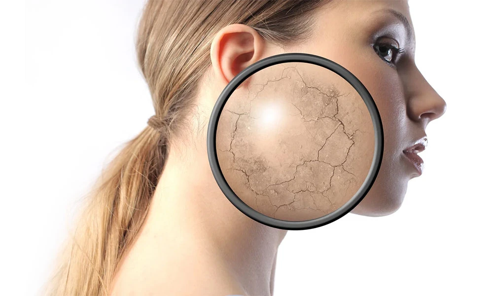 сухой тип кожи