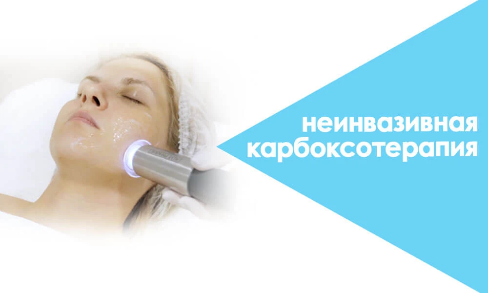 неінвазивна карбокситерапія