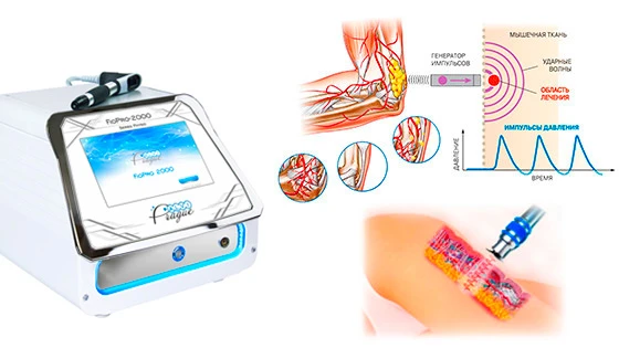 апарати ударно хвильової терапії купити київ ціна