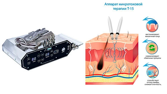 аппарат микротоки купить киев