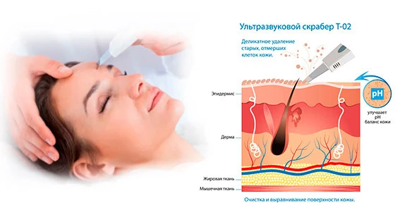 ультразвуковые скраберы преимущества
