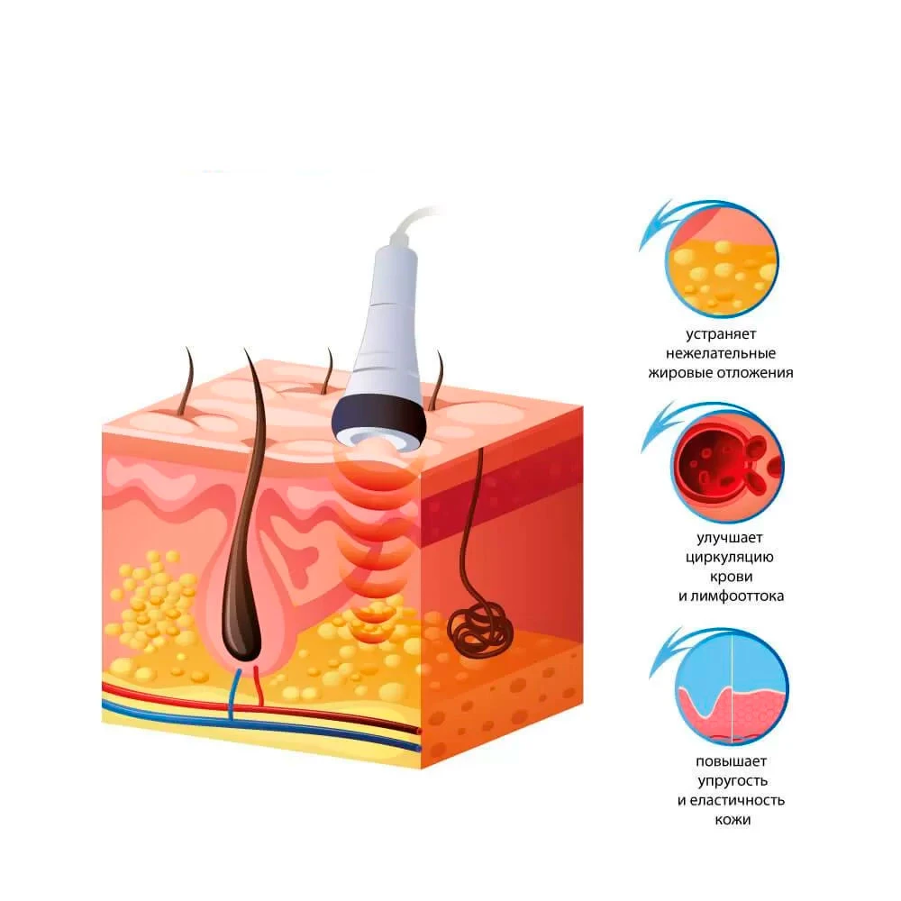апарат для вакуумного масажу купити київ ціна