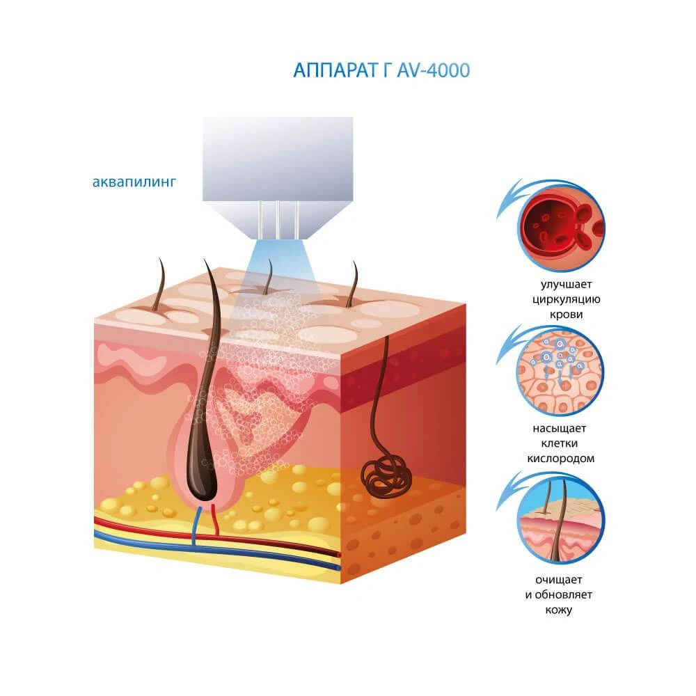 аппарат газожидкостного пилинга av-4000 купить