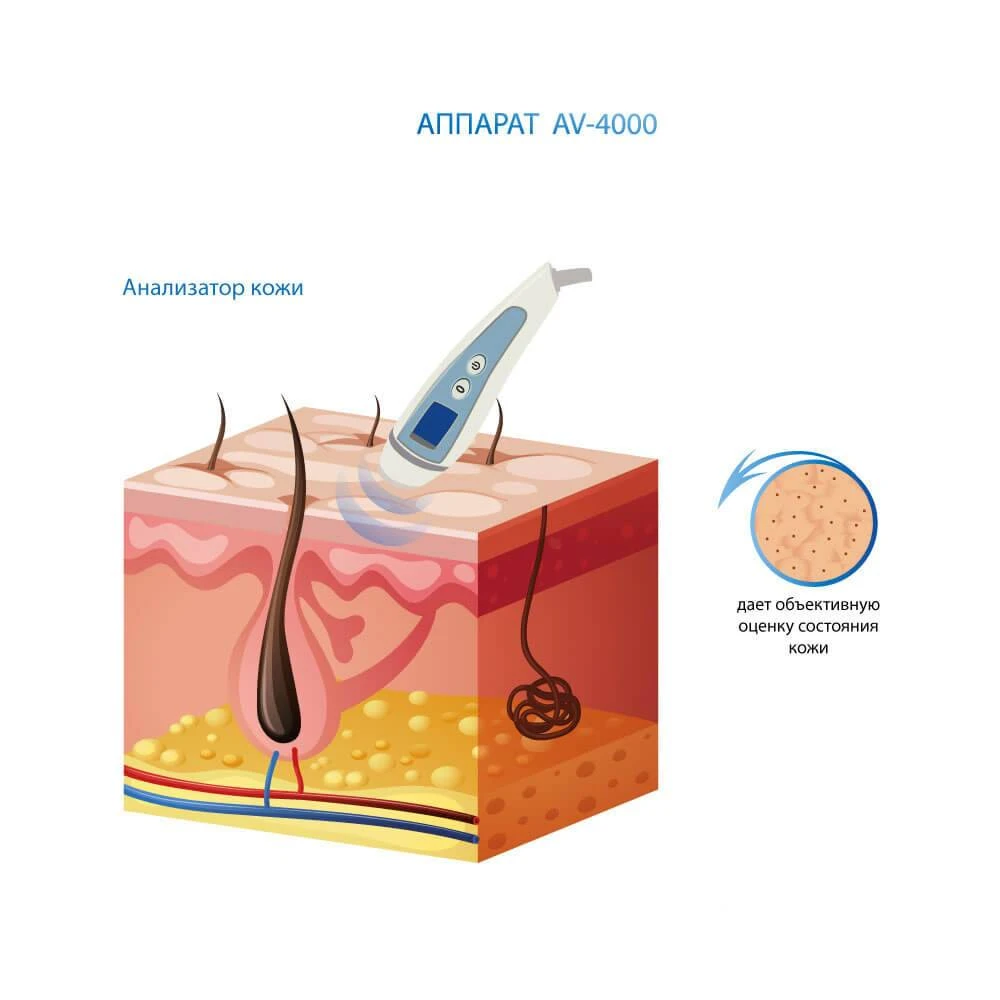 анализатор кожи аппарат газожидкостного пилинга av-4000