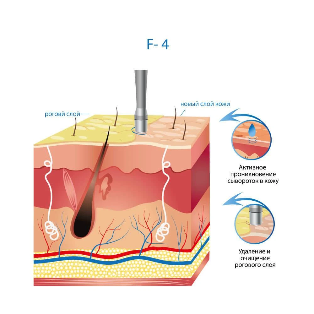косметологический комбайн ф-4 алмазной микродермабразии купить