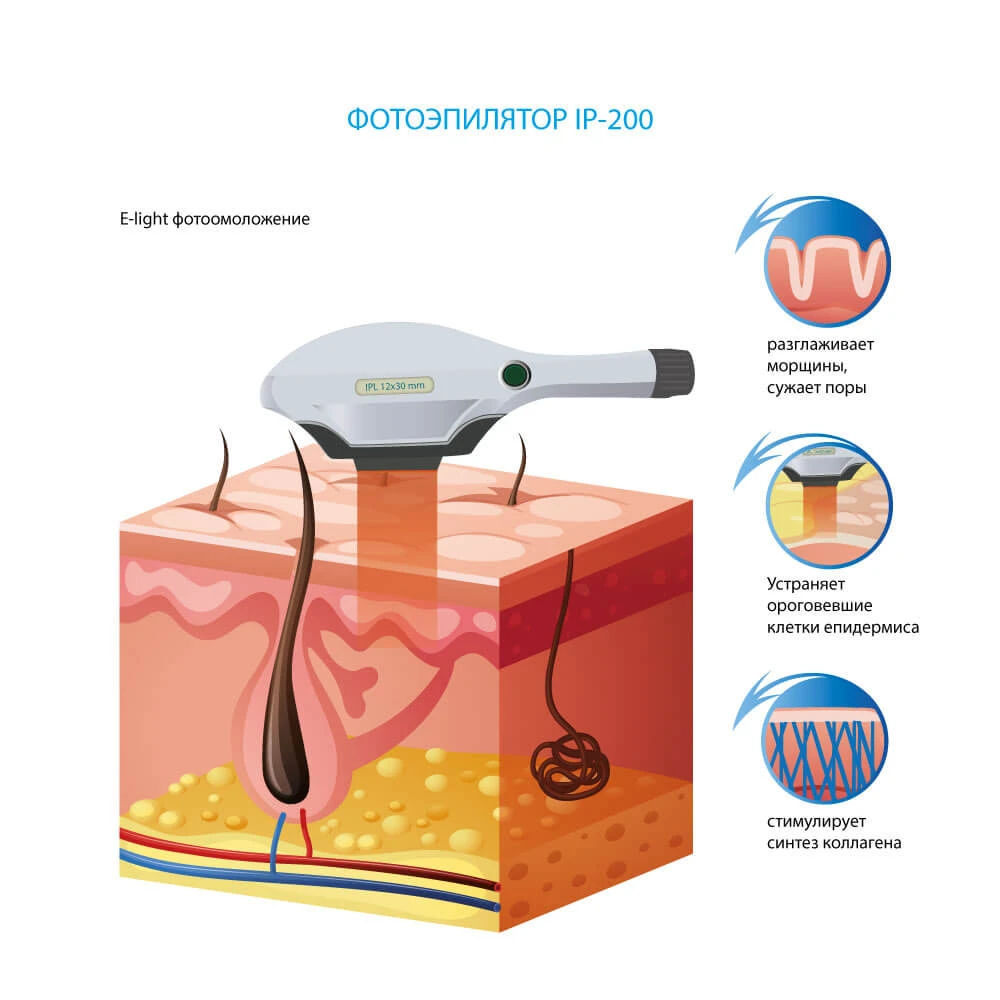 апарати фотоомолодження України