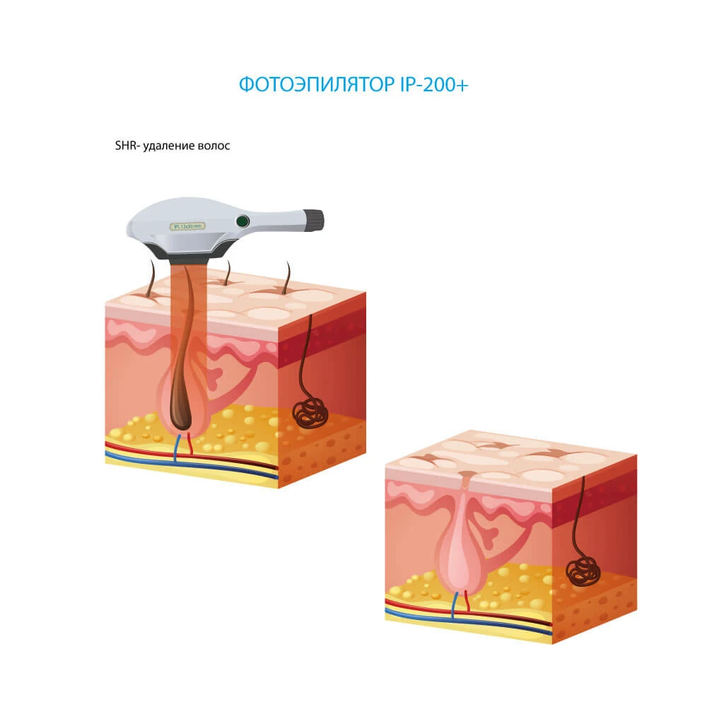 shr фотоепілятор волосся ціна україна