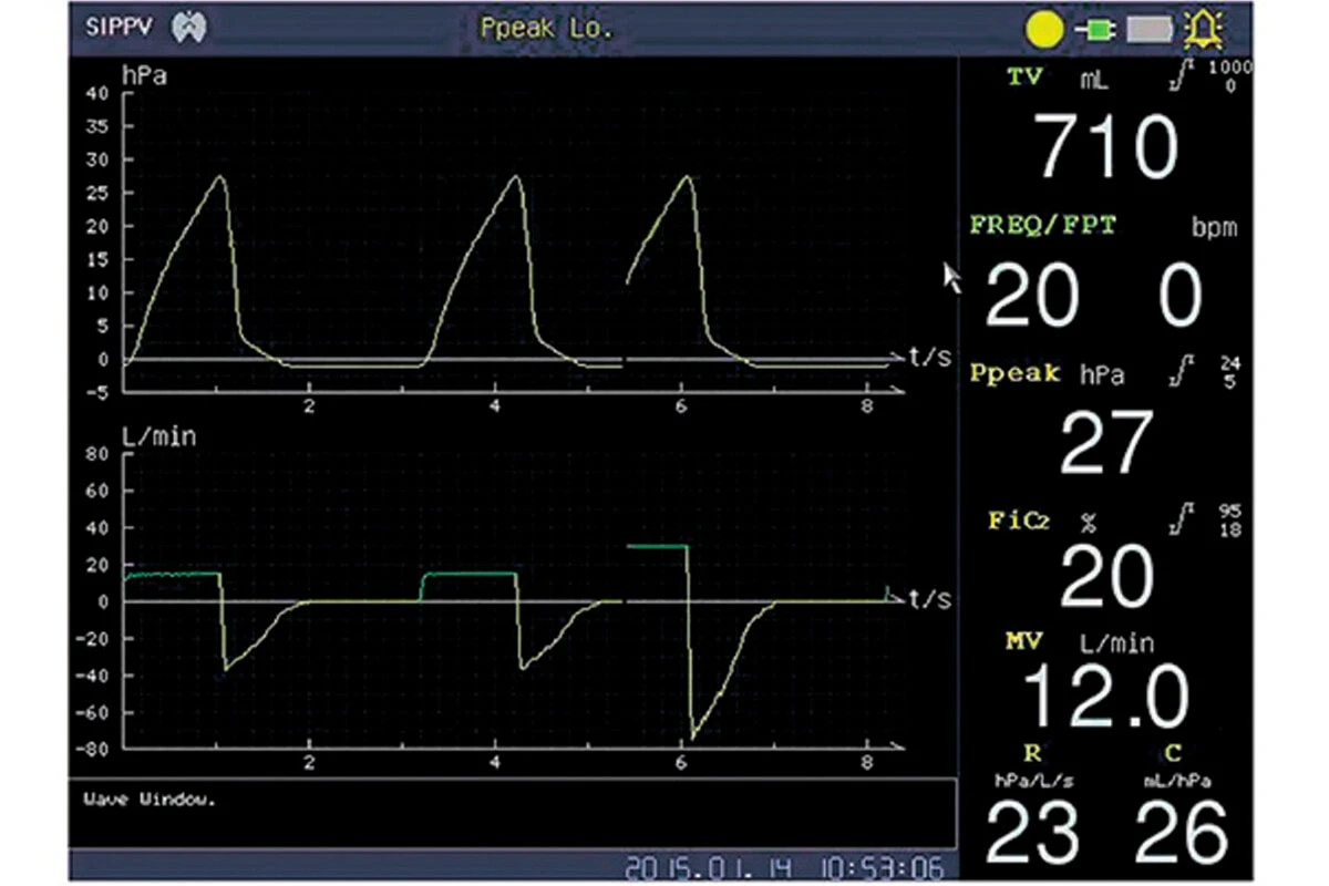 апарат штучної вентиляції легенів швл olv70b професійний вартість