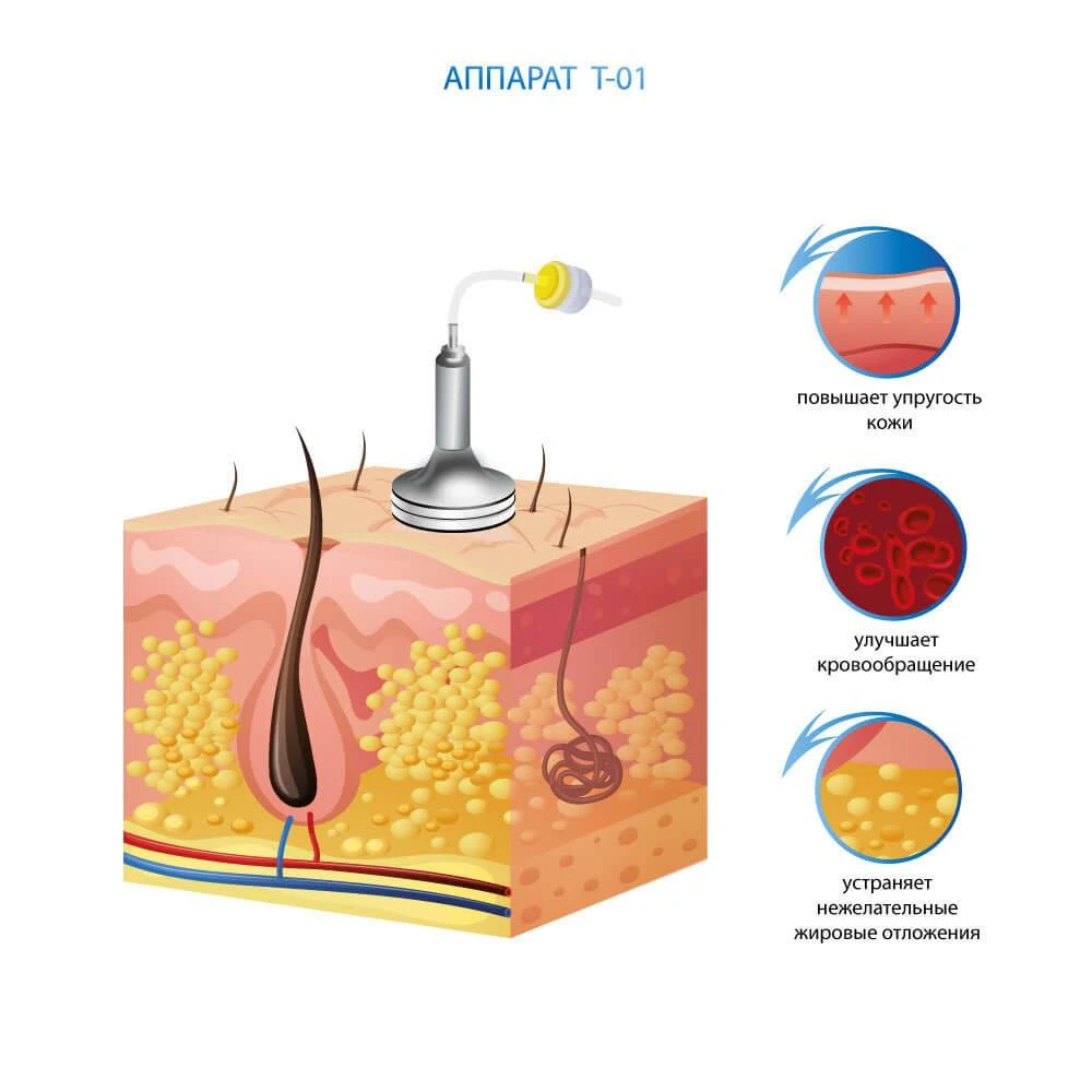 преимущества аппарата вакуумного-роликового массажа t-01