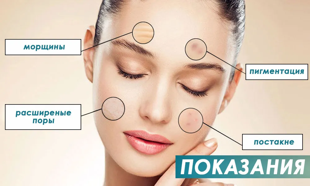 показання до алмазної мікродермабразії