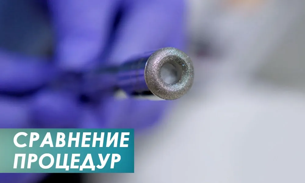 порівняння ефективності процедур алмазної мікродермабразії