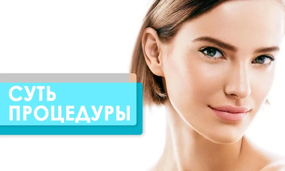 суть процедури карбонового пілінгу