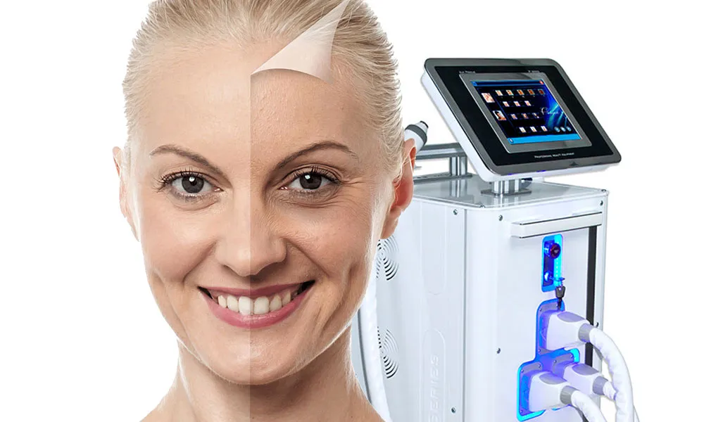 Ефекти фотоомолодження