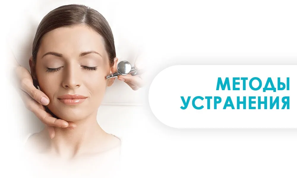 методы устранения тканевой гипоксии
