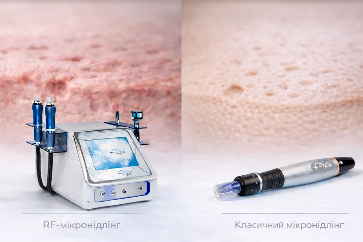 RF-мікронідлінг чи класичний мікронідлінг