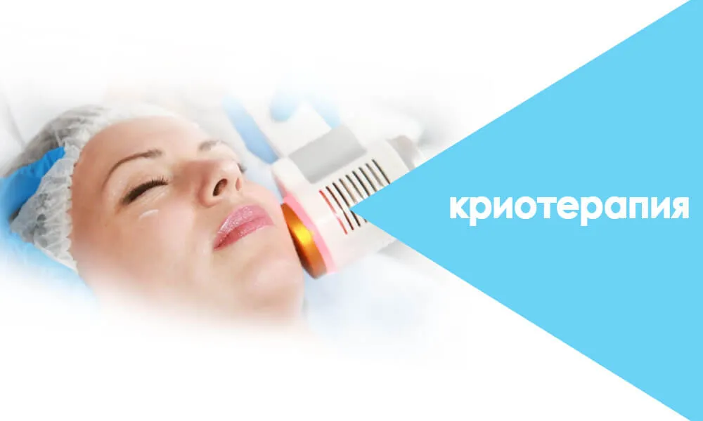криотерапия