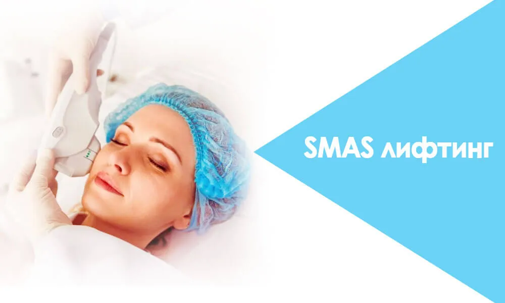 SMAS лифтинг