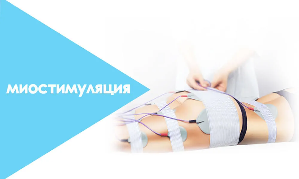 миостимуляция