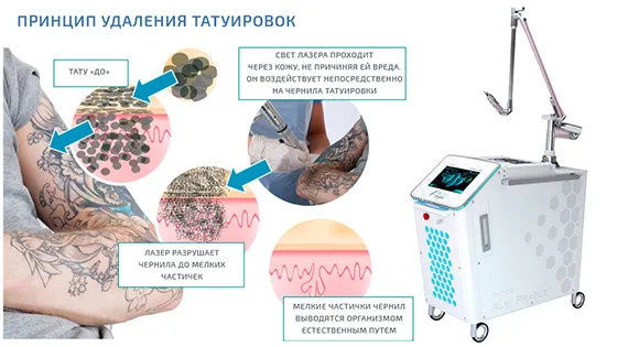 принцип работы пикосекундных лазеров