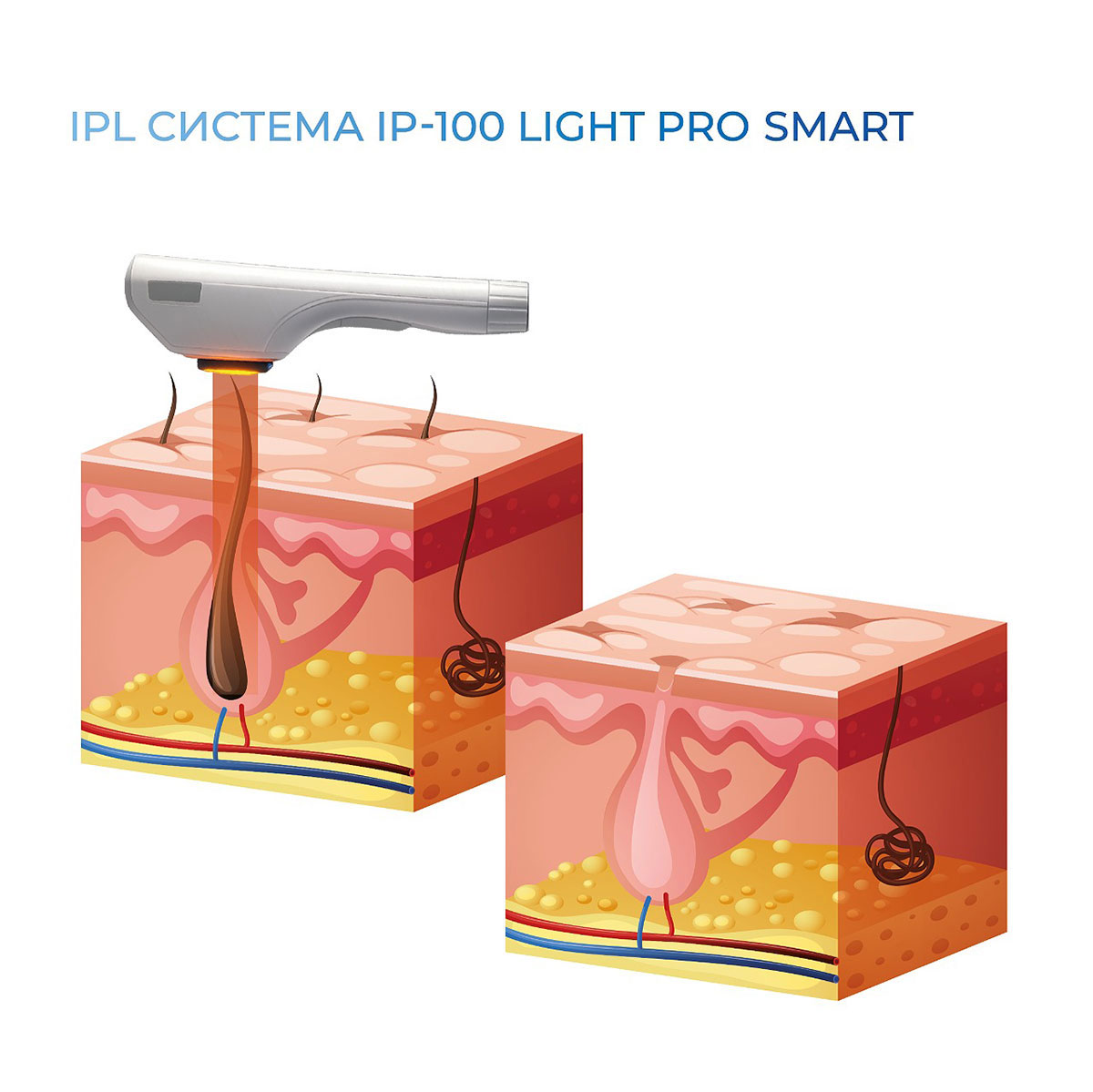 можливості IP-100 Light Pro смарт