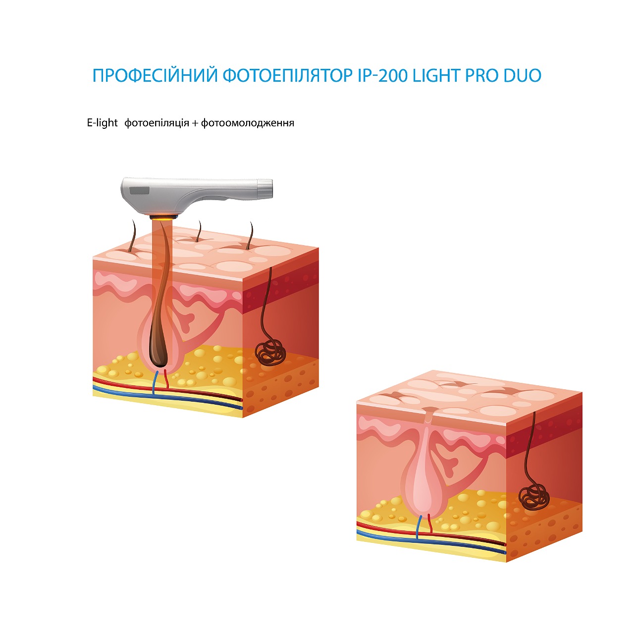 професійна фотосистема IP-200 Light Pro Duo.